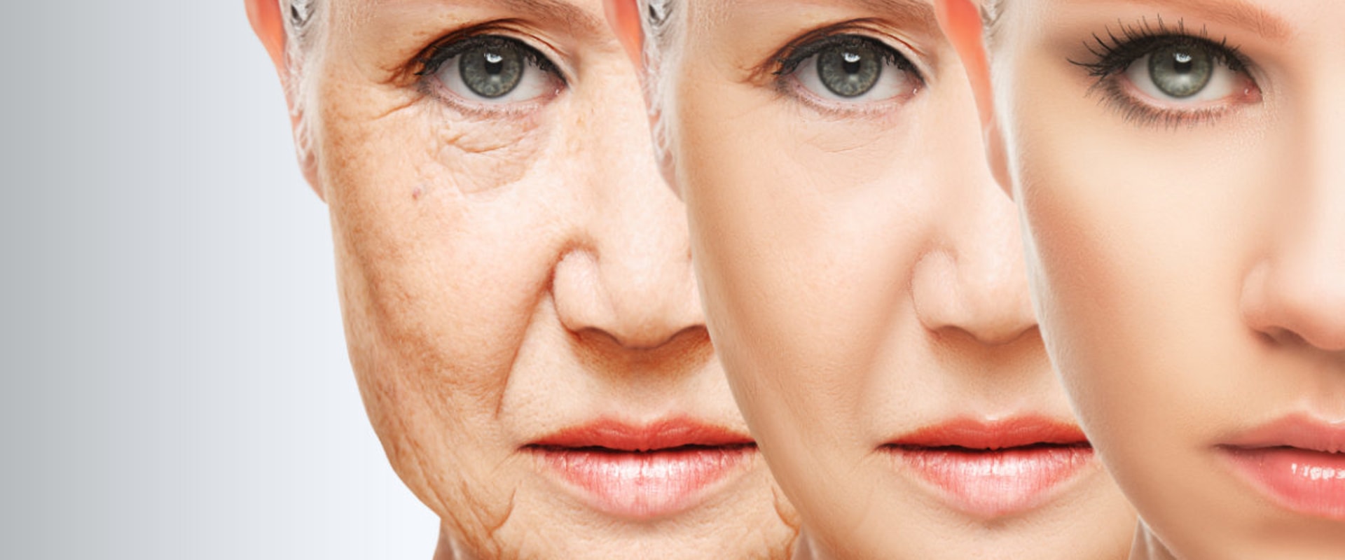 Wrinkle Reduction Treatments: An Overview