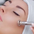 Microdermabrasion Facials: Everything You Need to Know