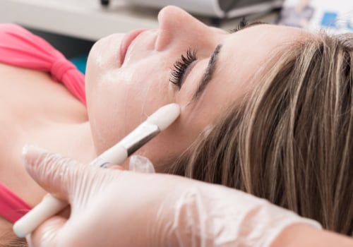 Chemical Peels: Understanding the Medical Spa Procedure