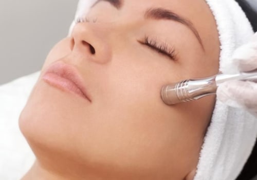 The Benefits of Microdermabrasion Facials